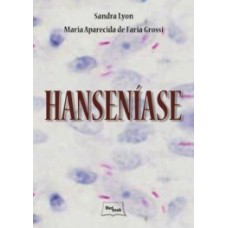 Hanseníase