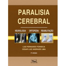 Paralisia cerebral