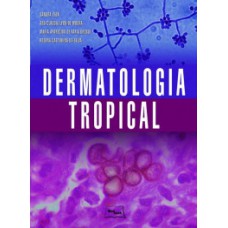 Dermatologia tropical