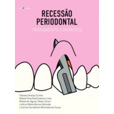 Recessão periodontal