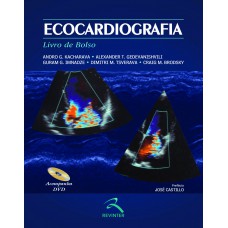 Ecocardiografia