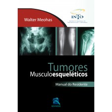 Tumores Musculoesqueléticos