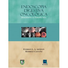 Endoscopia Digestiva Oncológica