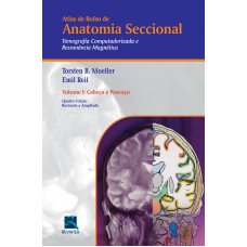 Atlas de Bolso de Anatomia Seccional - Tomografia Computadorizada e Ressonância Magnética - Volume I