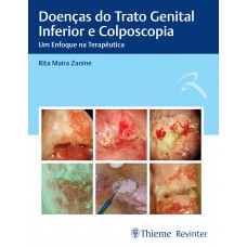 Doenças do Trato Genital Inferior e Colposcopia