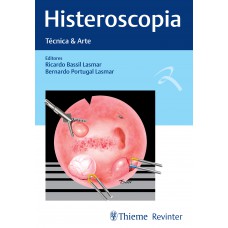 Histeroscopia