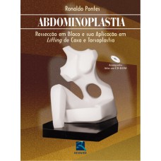 Abdominoplastia