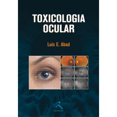 Toxicologia Ocular