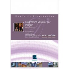 Diagnóstico vascular por imagem