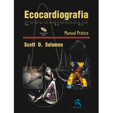 Ecocardiografia