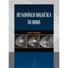 Ressonância Magnética da Mama