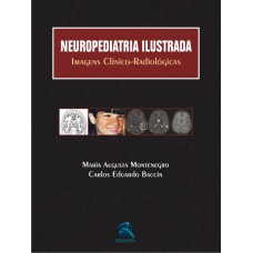 Neuropediatria Ilustrada