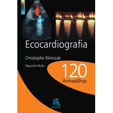 Ecocardiografia