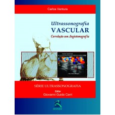 Ultrassonografia Vascular