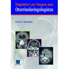 Diagnóstico por Imagem para Otorrinolaringologistas