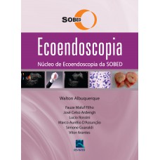 Ecoendoscopia