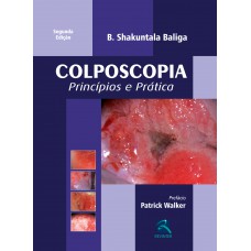 Colposcopia