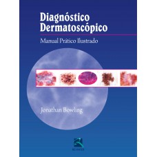 Diagnóstico Dermatoscópico