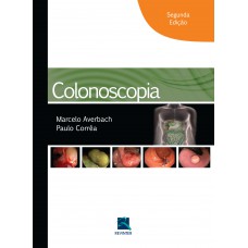 Colonoscopia