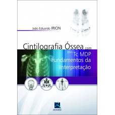 Cintilografia Óssea com 99M Tc MDP