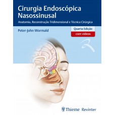 Cirurgia Endoscópica Nasossinusal