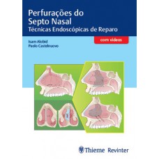 Perfurações do Septo Nasal