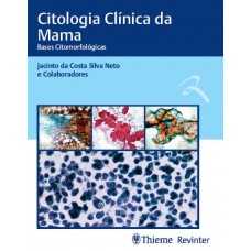 Citologia Clínica da Mama