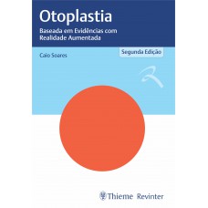 Otoplastia