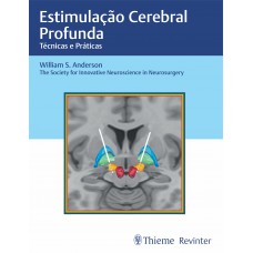 Estimulação Cerebral Profunda