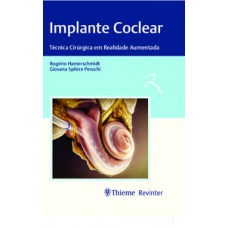Implante coclear Implante coclear
