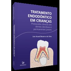 Tratamento endodôntico em crianças