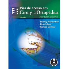 Vias De Acesso Em Cirurgia Ortopedica