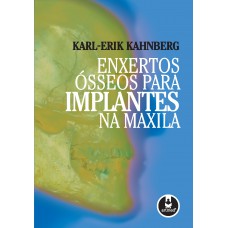 Enxertos Ósseos para Implantes na Maxila