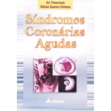 Síndrome Coronárias Agudas