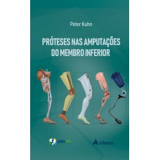 Próteses nas Amputações do Membro Inferior