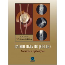 Radiologia do Joelho