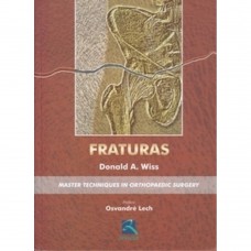 Fraturas Fraturas