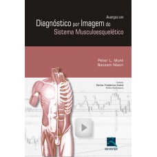 Avanços em Diagnósticos por Imagem do Sistema Musculoesquelético