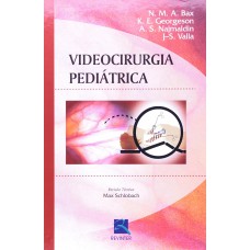 Videocirurgia Pediátrica Videocirurgia Pediátrica