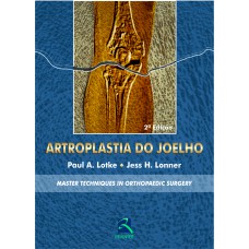 Artroplastia do Joelho