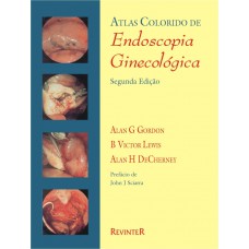 Atlas Colorido de Endoscopia Ginecológica