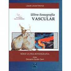 Ultrassonografia Vascular