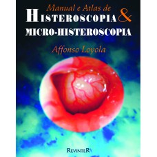 Histeroscopia e Micro-Histeroscopia