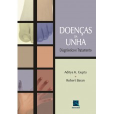 Doenças da Unha