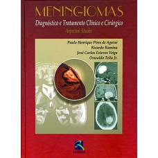 Meningiomas