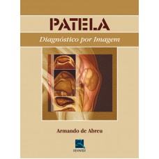 Patela