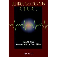 Eletrocardiografia Atual