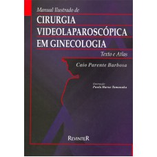 Cirurgia Videolaparoscópica em Ginecologia