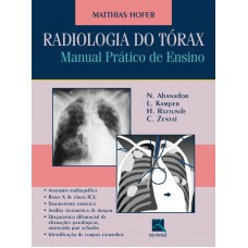 Radiologia do Tórax