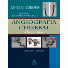 Angiografia Cerebral Diagnostica